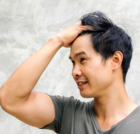 Hair Transplant Guide 2023: Will I lose hair after a hair transplant?