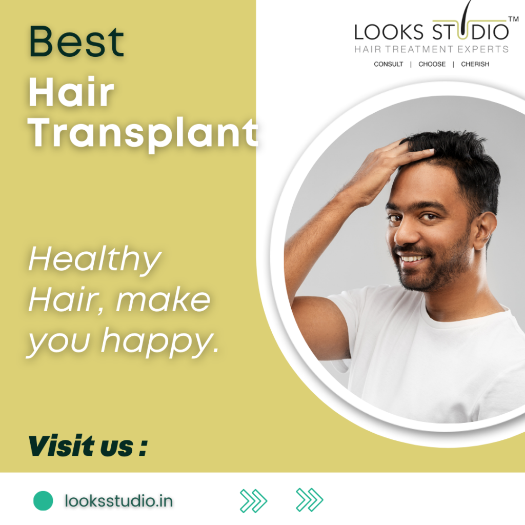 What is Hair Transplant: Method, Risk, Cost, During and Post Procedure  things and More: Looks Studio(2023) - Hair Transplant | Looksstudio | Blog