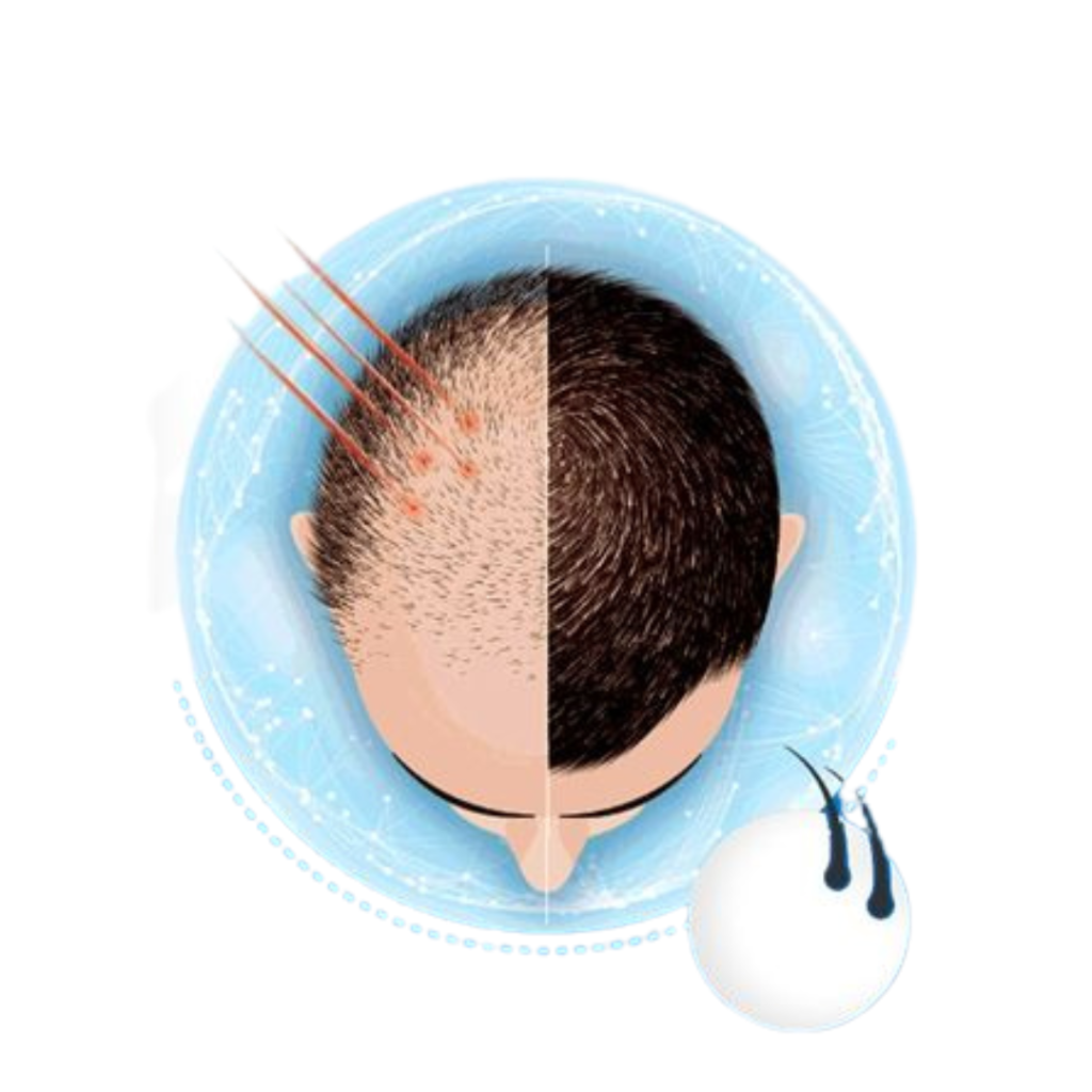 Hair transplant Cost in Mumbai