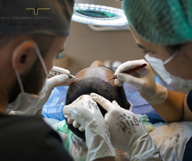 Surgeon’s Experience Hair Transplant Results