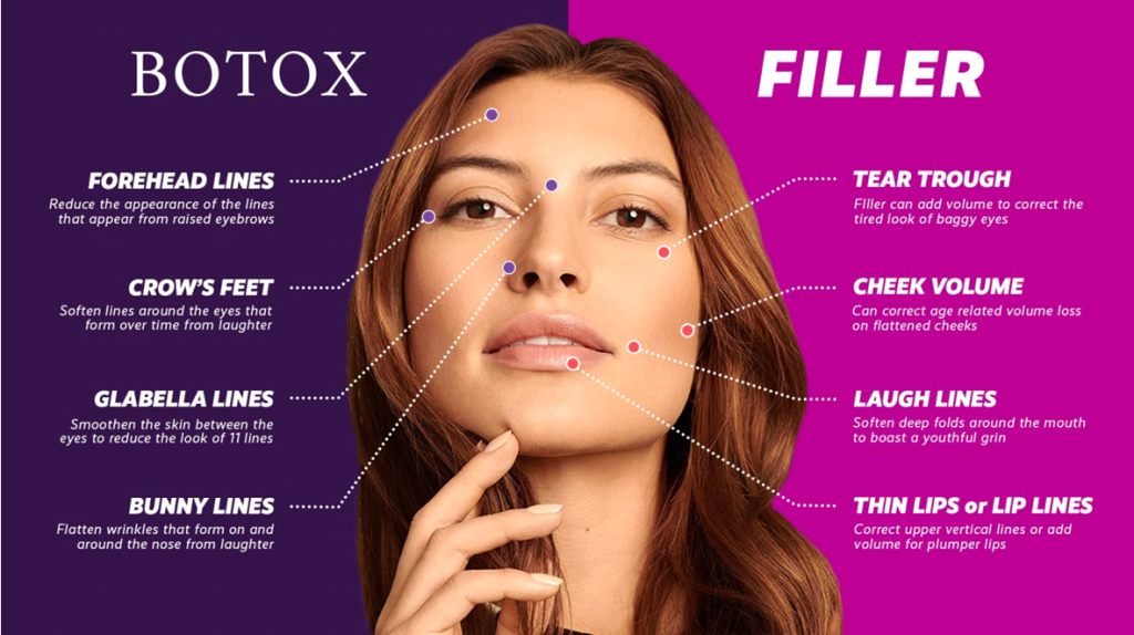 Dermal Fillers vs. Botox