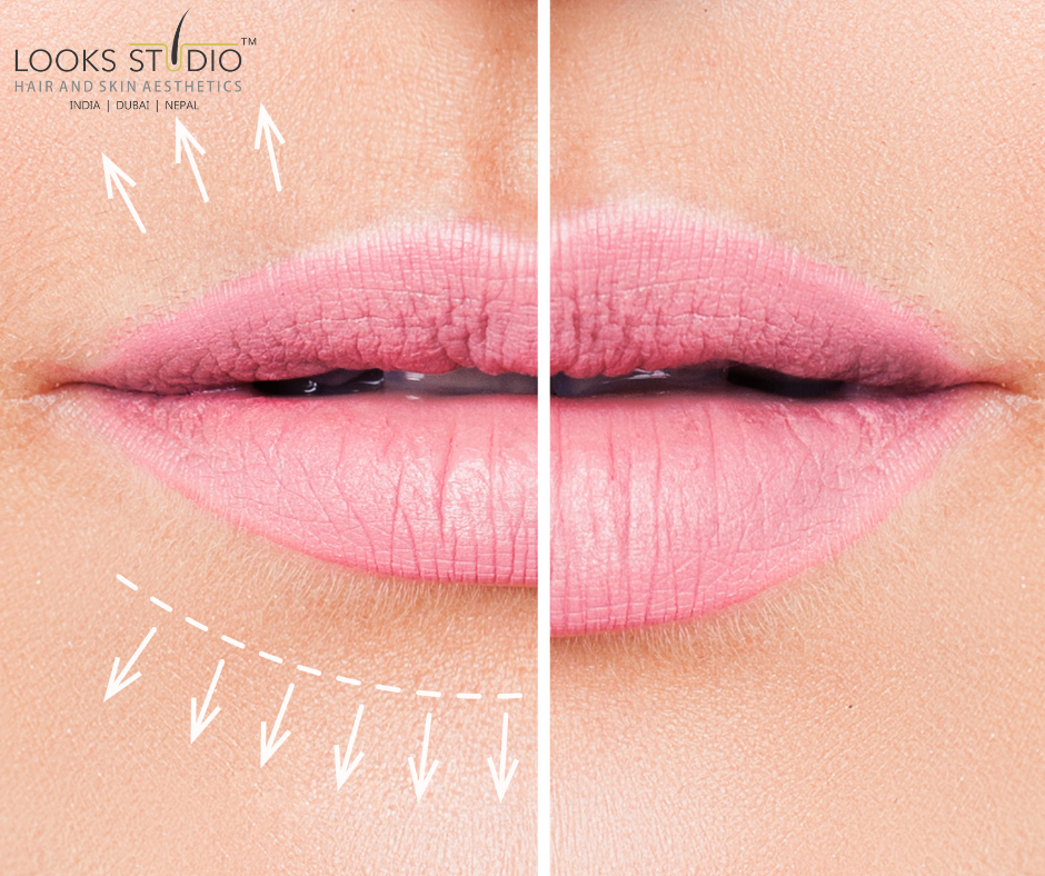 Unlocking the Secrets of Fillers in Cosmetics: What are They and What Do They Do?