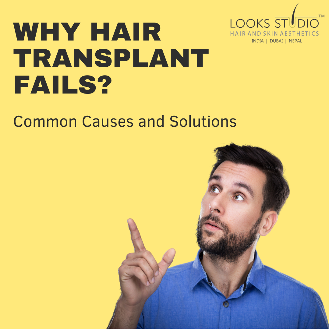 Why Hair Transplant Fails: Common Causes and Solutions