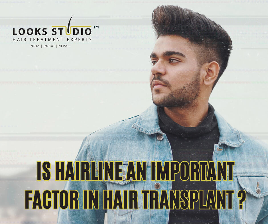 Is Hairline An Important Factor To Consider When Getting Hair Transplant?