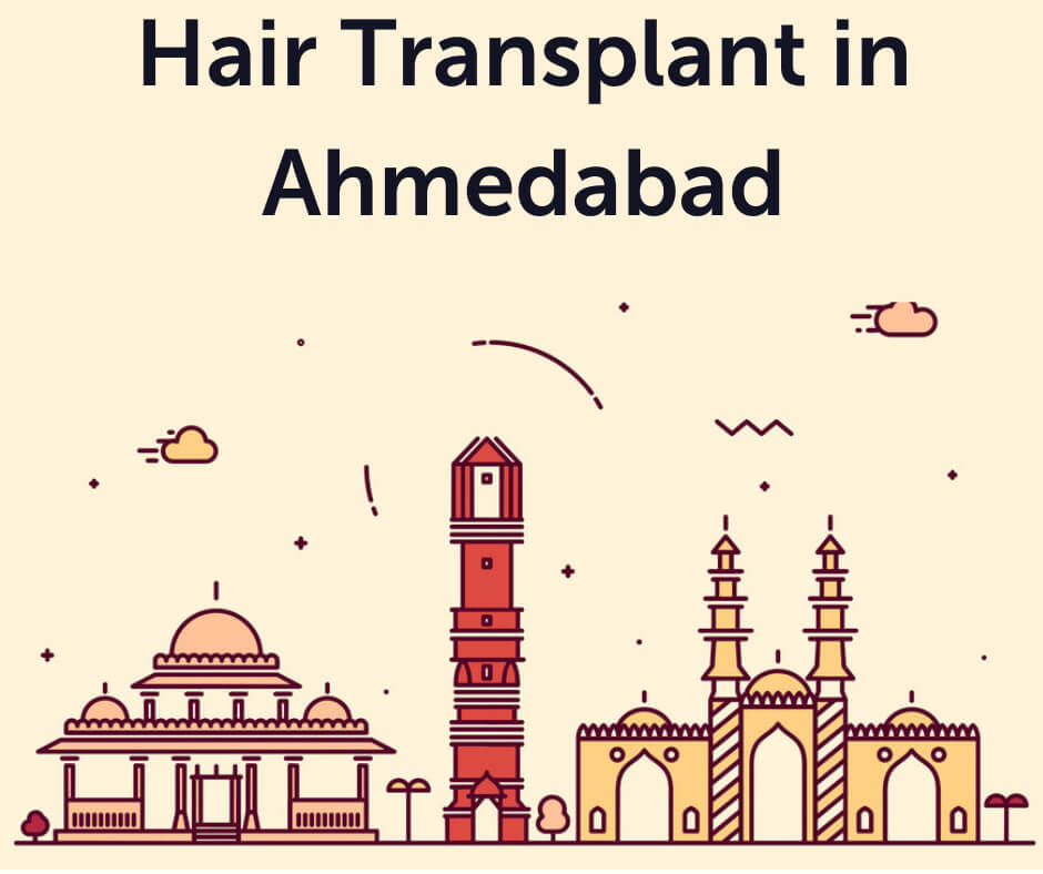 Hair Transplant In Ahmedabad