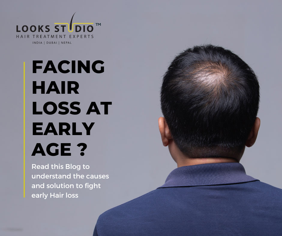 Facing Hair Loss Before the Age of 25