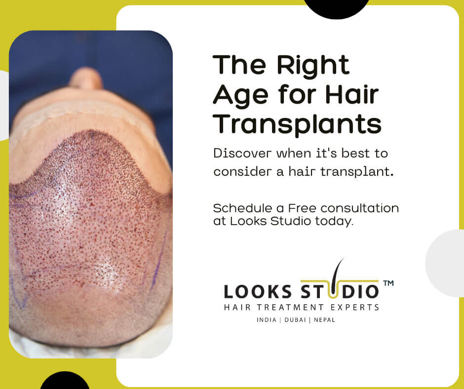 What Is The Right Age For A Hair Transplant