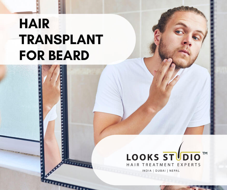 Hair transplant in Beard