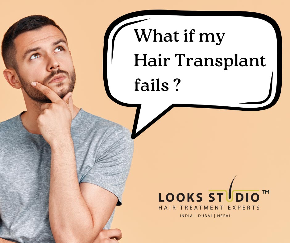 What if my Hair Transplant fails?