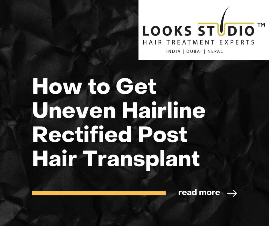 How to Fix an Uneven Hairline After Hair Transplant: Solutions and Tips