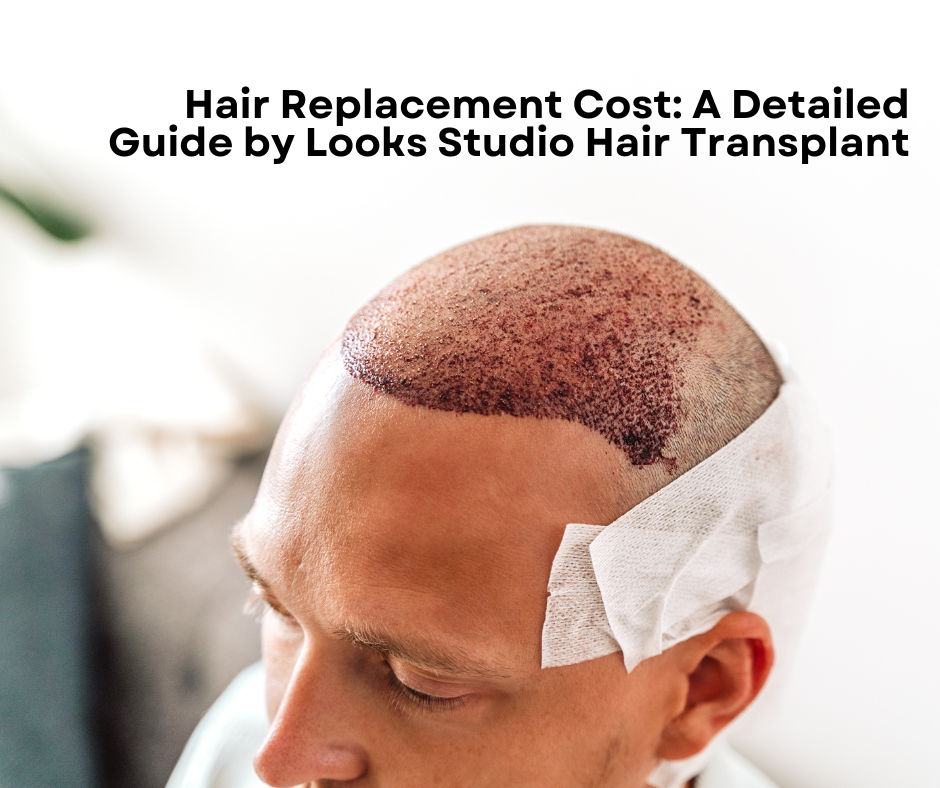 Hair Replacement Cost: A Detailed Guide by Looks Studio Hair Transplant