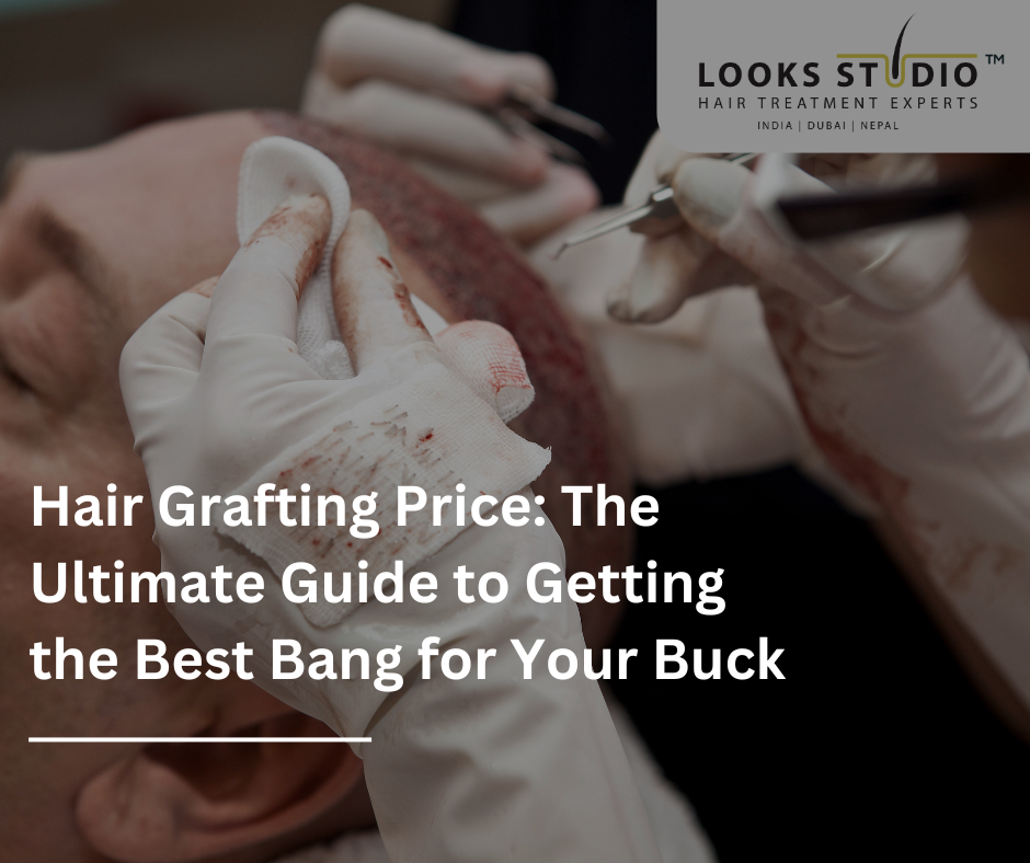 Hair Grafting Price: The Ultimate Guide to Getting the Best Bang for Your Buck