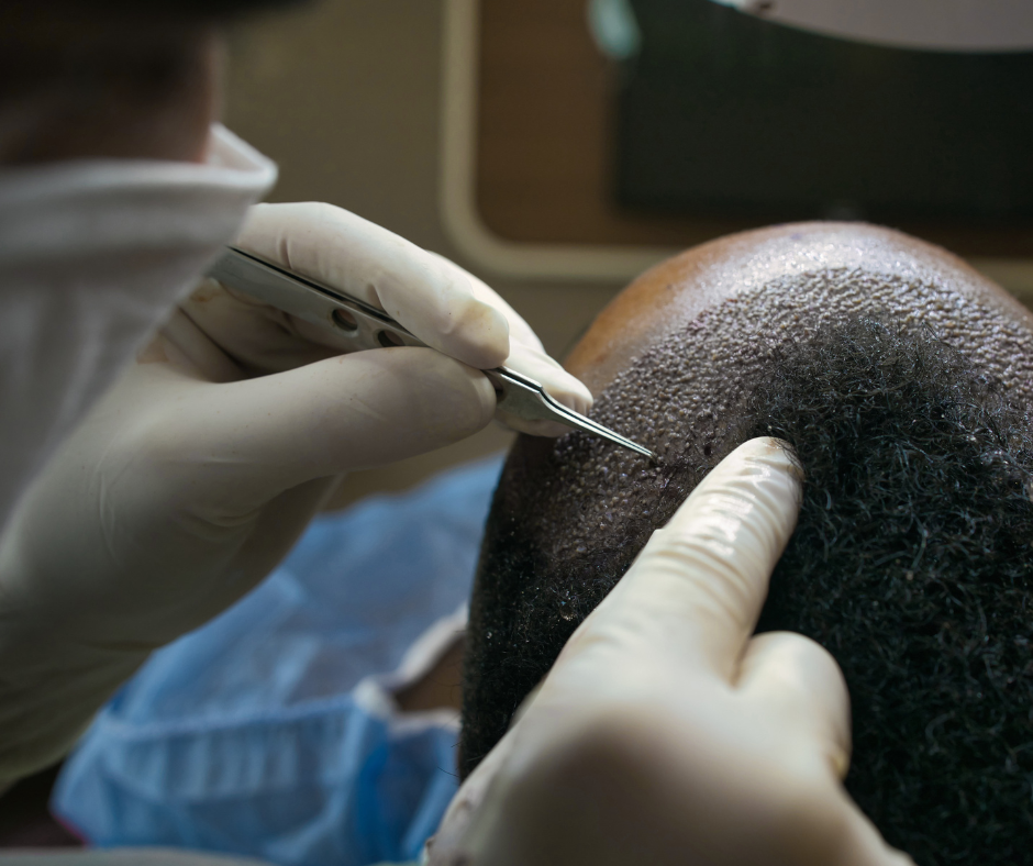 Hair Follicle Surgery Cost