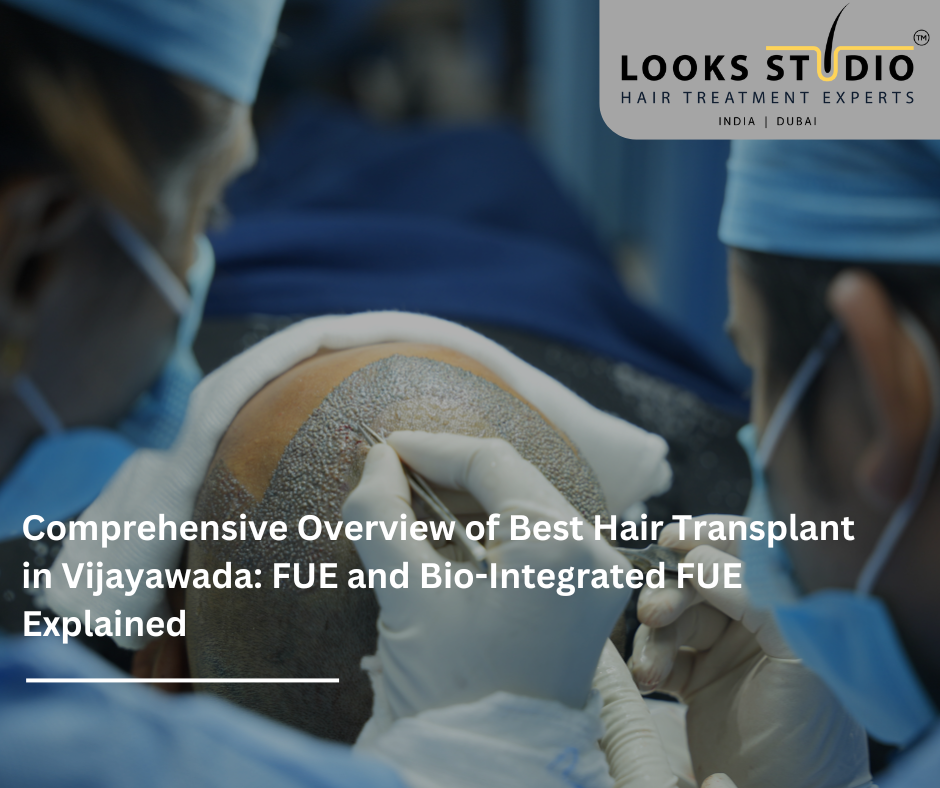 Comprehensive Overview of Best Hair Transplant in Vijayawada: FUE and Bio Integrated FUE Explained