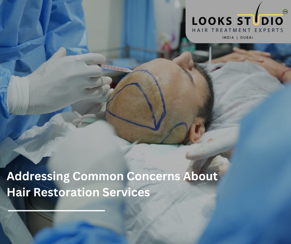 Addressing Common Concerns About Hair Restoration Services