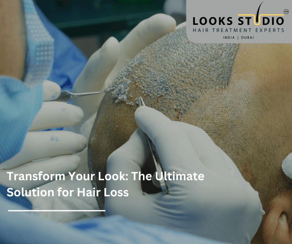 Transform Your Look: The Ultimate Solution for Hair Loss