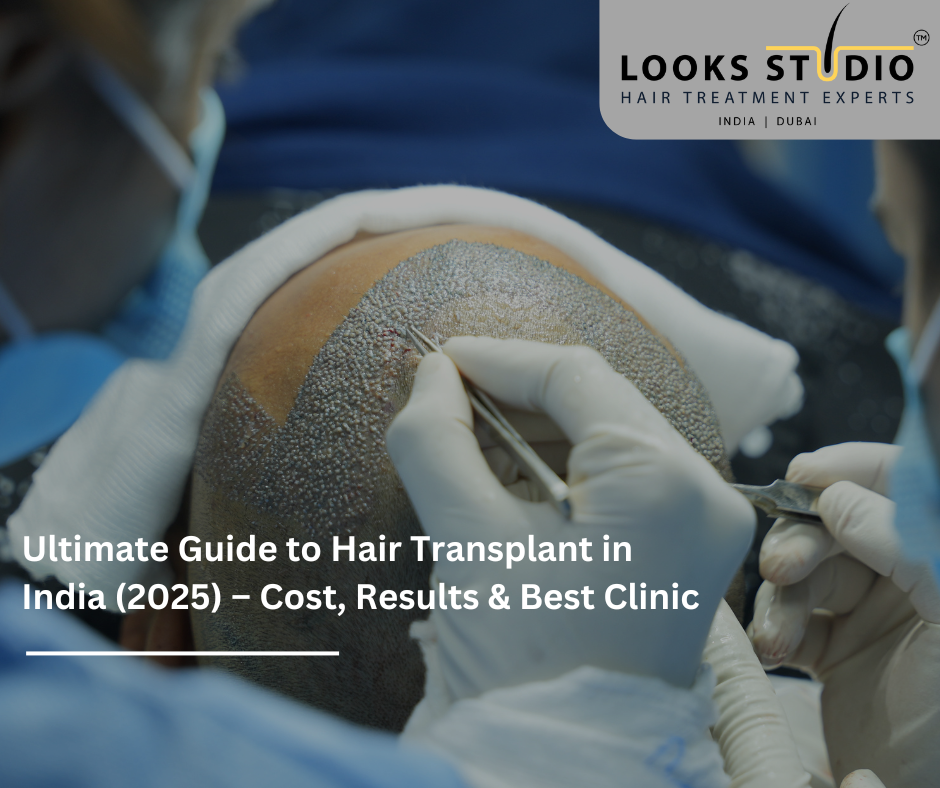 Ultimate Guide to Hair Transplant in India (2025) – Cost, Results & Best Clinic