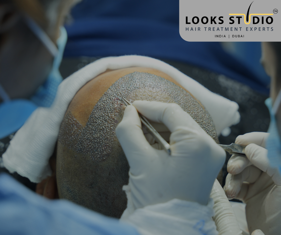 Best Hair Transplant Clinic in India