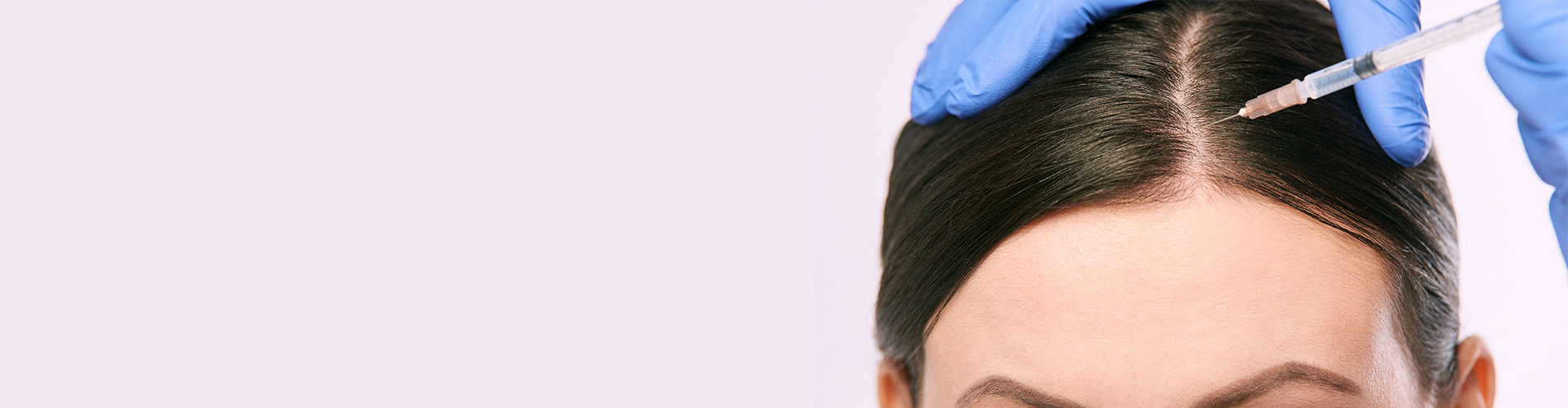 Hair Transplant for Women in 2023  Hermest Clinic Turkey