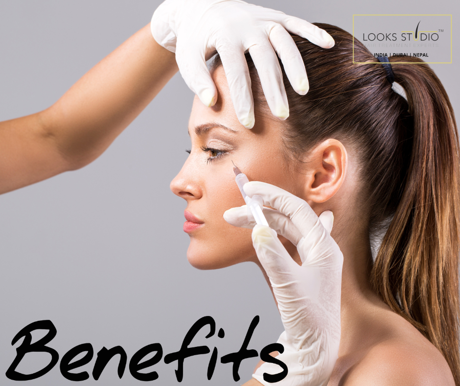 Benefits of Botox