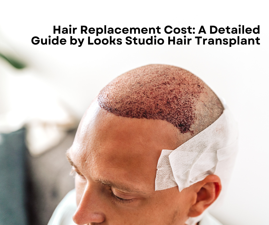 hair replacement cost