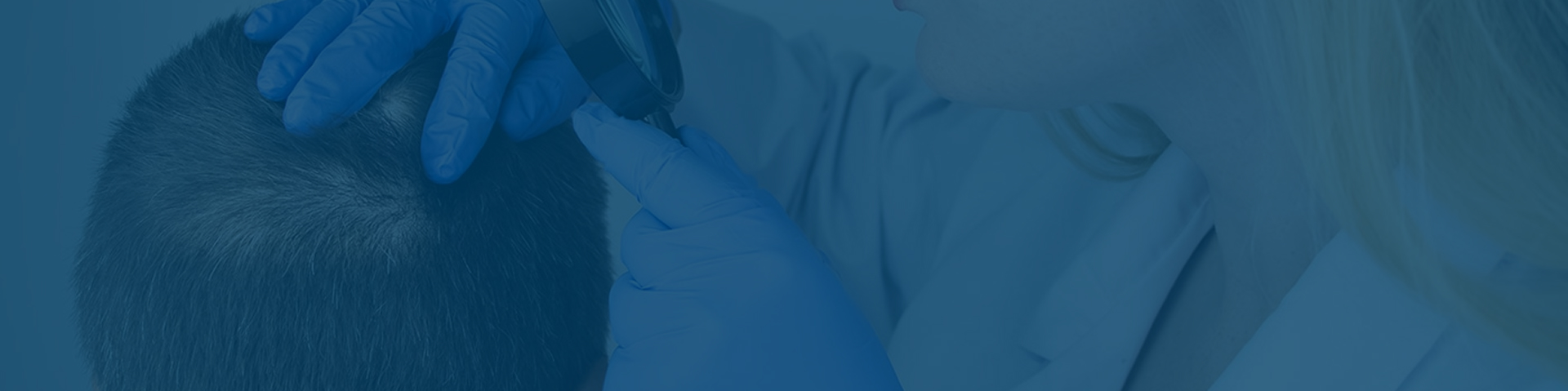 Hair Transplant Treatment