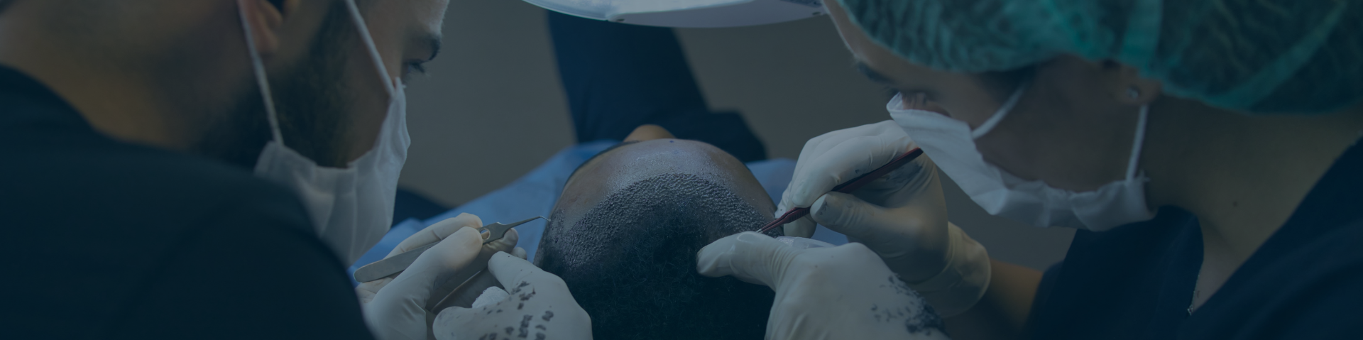 Best Hair Transplant in Pimple Saudagar
