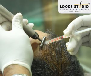 GFC vs PRP - Looks Studio