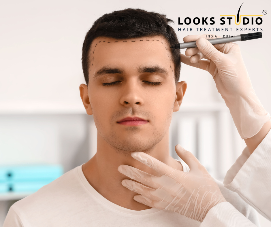 Free Hair Transplant Consultation