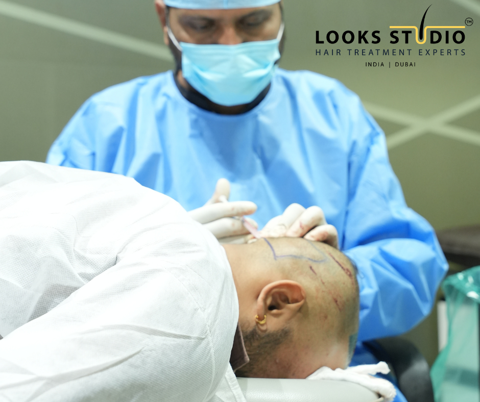 Do you need a long weekend for a hair transplant