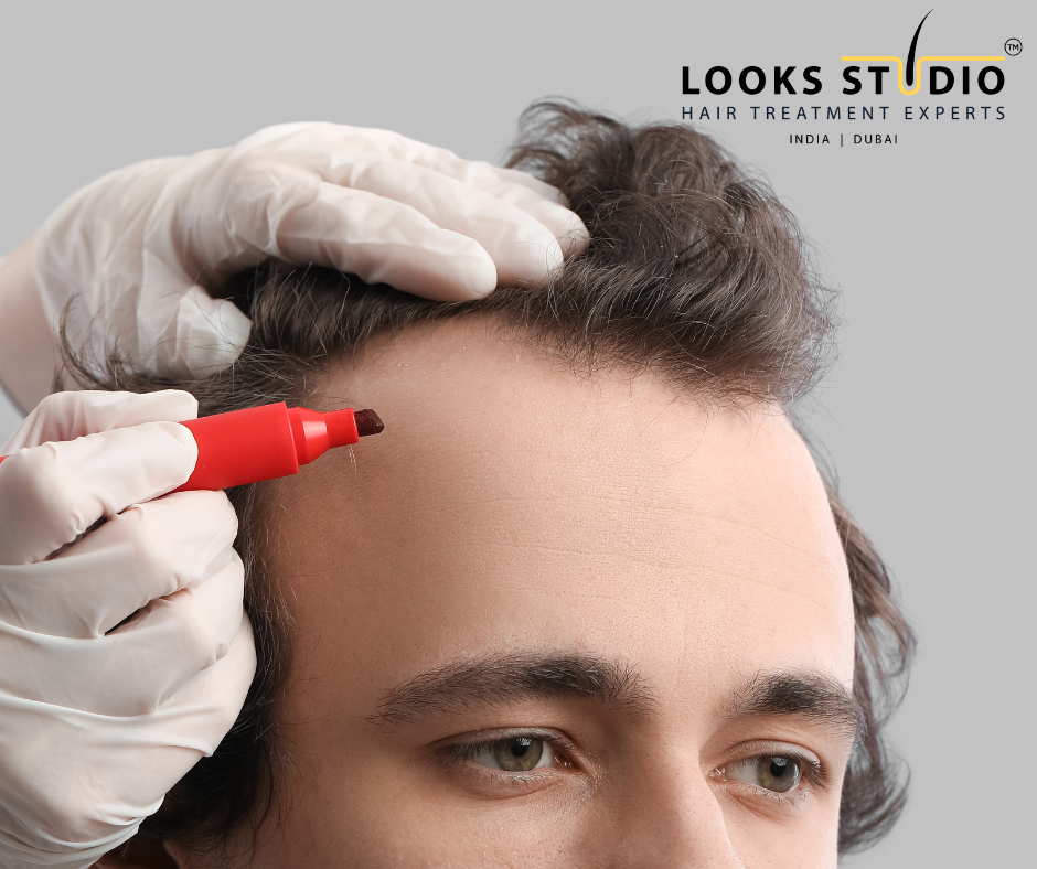 Hair Follicle Surgery Readiness