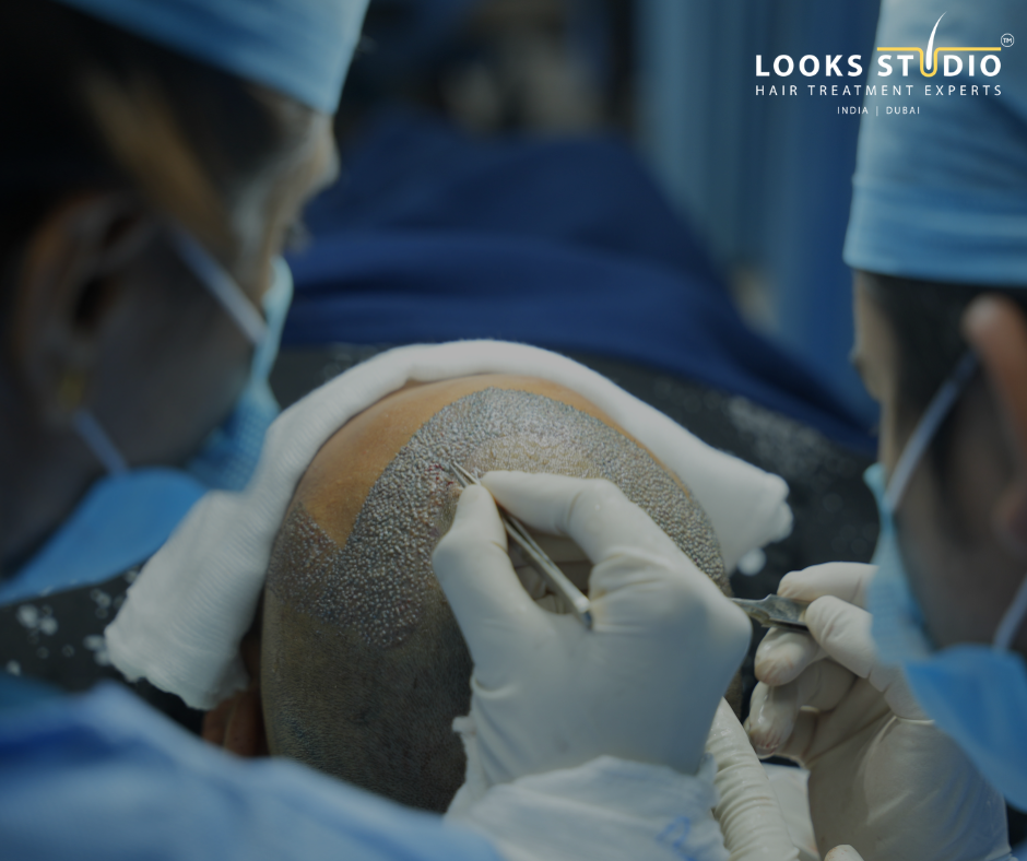 Bio Integrated FUE™ vs Traditional FUE vs DHT