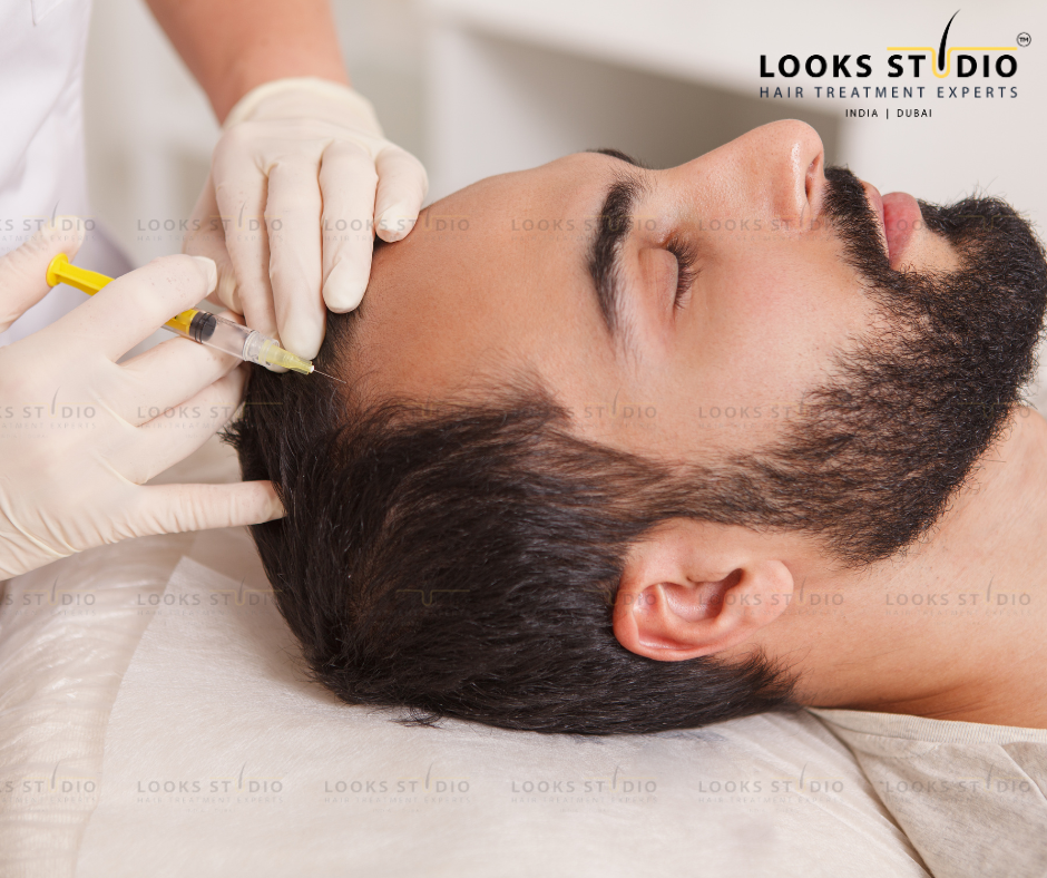 prp vs gfc hair loss